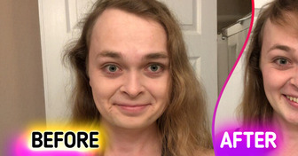 21 Times Bangs Worked Better Than Any Plastic Surgery