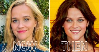 How 15 Celebs Looked Before They Found Their Iconic Hairstyles