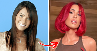 Megan Fox Candidly Reveals Every Single Plastic Surgery She’s Had Done, but One