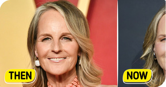 Helen Hunt, 61, Stuns in Recent Appearance—Her LIPS Become the Main Focus