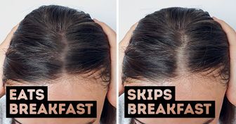 10 Daily Habits That Are Causing Your Hair to Thin