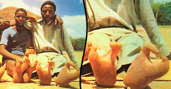 The African Tribe With Ostrich Feet: Why They Only Have Two Toes on Each Foot