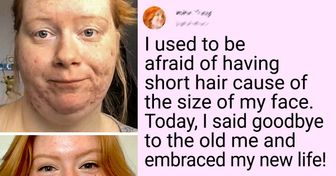 13 People Who Accepted Their Imperfections and Started to Live a Full Life