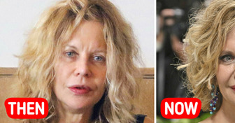 “STOP With the Fillers”, Meg Ryan Attends Met Gala After 20 Years and Shocks Fans