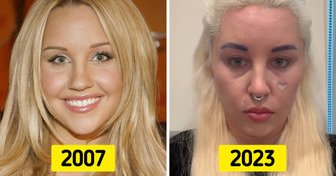 “She’s the Man” Star Amanda Bynes Explains Why She Looks Different Now