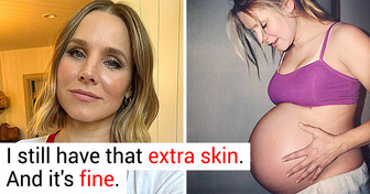 10 Famous Women Who Got Real About the Imperfections of Their Post-Baby Body
