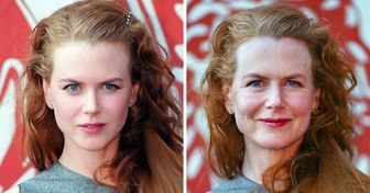 A Plastic Surgeon Reveals How 10 Celebrities Would Look If They Aged Like Average People