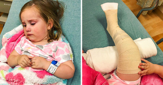 Little Girl Ends Up With a FULL BODY CAST After Slide Incident and the Reason Why Will Hunt Every Parent