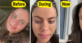Woman Stops Washing Her Face Completely as Skincare, and Shocks With Her Transformation