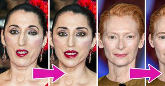 What Famous Actresses With Unusual Appearances Would Look Like If They Underwent Popular Beauty Procedures