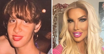 Meet the Woman Who Spent Millions to Resemble Barbie