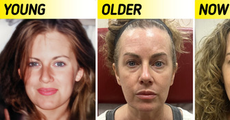 A Woman Used Botox Because She Wanted to Look Like Her Younger Self, and According to People Online She Succeeded
