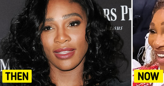 “Stop with the Botox” People React as Serena Williams’ Latest Appearance Sparks Concern