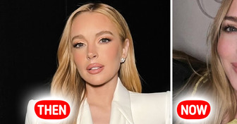 “Face Transplant,” Lindsay Lohan’s Latest Photo Causes Major Stir—People Notice One Detail