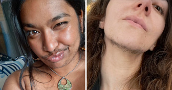 13 Women Who Proudly Let Their Body Hair Steal the Show