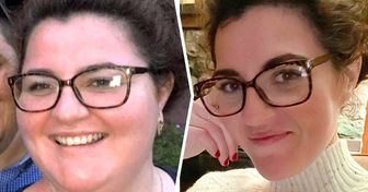 People Share 20 Progress Pics That Show How Weight Loss Can Change Your Face