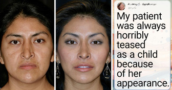 15 Daring People Who Got Plastic Surgery and Transformed Themselves