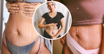 Mom Reveals a Postpartum Body 10 Years After Giving Birth and Delivers an Important Lesson