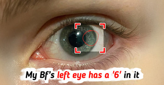 10+ People With Rare Physical Features That Will Open Your Heart to Love and Kindness