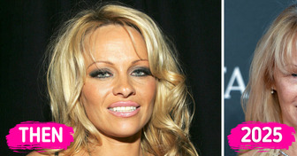 “She Looks Way Older,” Pamela Anderson Rocks Another Barefaced Look on the 2025 BAFTA Red Carpet