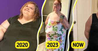 “1000-lb Sisters” Star Shows Off Her New Body in a Swimsuit After Skin Removal Surgery