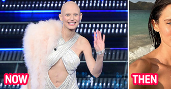 Victoria’s Secret Top Model Moves Everyone Showing Her Scar and Shaved Head at a Festival