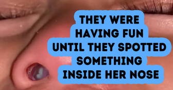 A Mother Found Something in Her Daughter’s Nose That Left Her Speechless