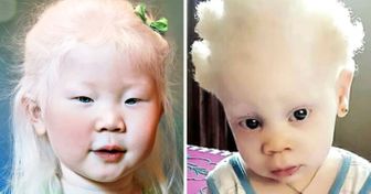 If You Have Ever Wondered What Albinos of Different Races Look Like, Well, Exactly Like This
