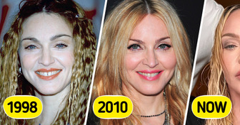 6 Celebrities Who Had Plastic Surgery, Then Absolutely Regretted It