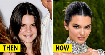 What 11 Celebrities Looked Like Before They Became Famous