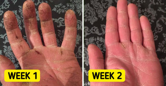 10 Cheap Products From Amazon That Could Be the Best Remedies for Your Skin