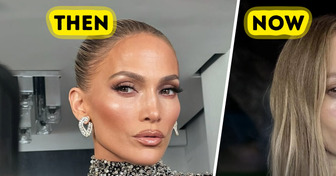 “So...This Happened,” Jennifer Lopez Posts Her Face Injury on Social Media, Shocking Fans