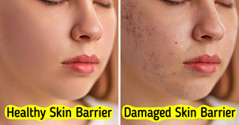 8 Warning Signs Your Skin Barrier Might Be Damaged