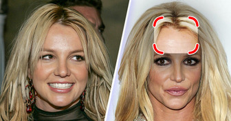 Why Britney Spears’ Facial Transformation Sparked Conversation