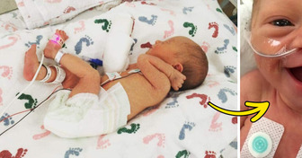 5-Days-Old Premature Baby SMILES and the Surprising Moment Goes Viral