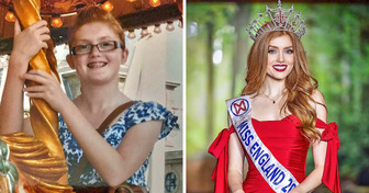 A Lady Was Bullied For Her Looks, Now Becomes the First Redhead to be Crowned Miss England
