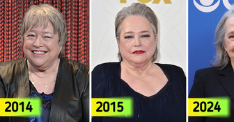 "She Doesn’t Look Healthy," People Are Worried for Kathy Bates After Massive Weight Loss at 76