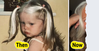 Woman, 24, Called a “Badger” Growing Up Shares How She Found Self-Love and Compassion While Living With a Rare Genetic Condition