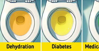 5+ Warning Signs Your Urine Color Might Be Telling You About Your Health