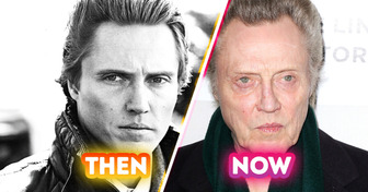 12 Celebs Who Look Unbelievably Different in Their Throwback Photos