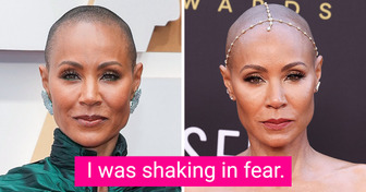 9 Celebrities Who’ve Opened Up About Hair Loss and Shown Many Women They’re Not Alone