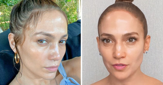 Dermatologist Reveals 4 Real Reasons Why Jennifer Lopez, 53, Doesn’t Age, and It’s More Than Plastic Surgery or Products