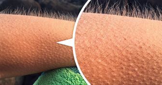 Goosebumps Serve as an Important Function in Our Bodies, and Scientists Have Only Just Learned About It