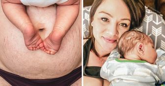 A Mother Was Told Her Stomach Was “Nasty,” but She Proves How Beautiful Women’s Bodies Really Are