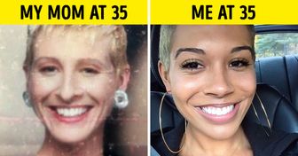 7 Reasons Why We Look Younger Than Our Parents at the Same Age