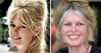 Hollywood Icon Brigitte Bardot, 89, Shocks Fans With a Jaw-Dropping Decision About Plastic Surgery