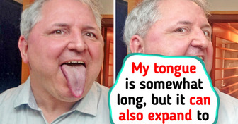 15 Unusual Human Body Features That Make Their Owners Unique