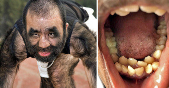 10 People With Extraordinary Physical Features We Can’t Believe Actually Exist