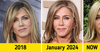 Why Jennifer Aniston’s Face Suddenly Started to Look Different
