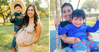 A Mother Loses Her Limbs After Giving Birth but Finds Solace in Her Baby’s Love